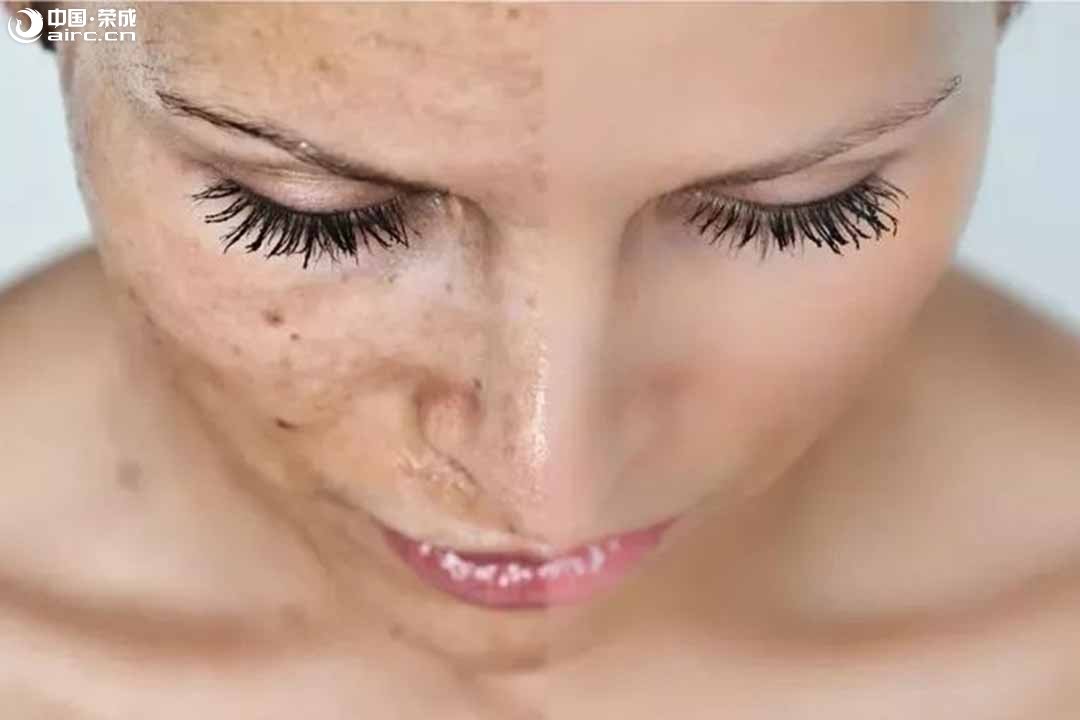 ӡӵ󼤹