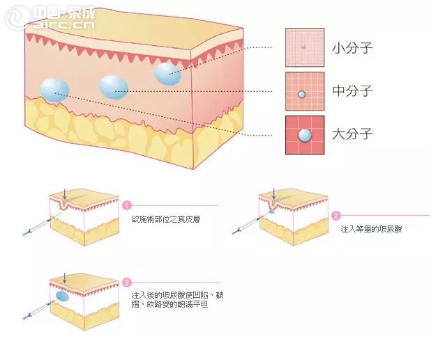 βģ